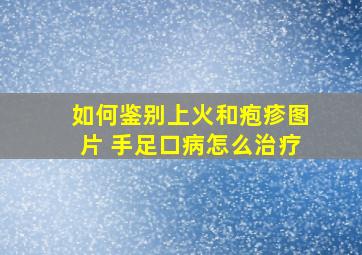 如何鉴别上火和疱疹图片 手足口病怎么治疗